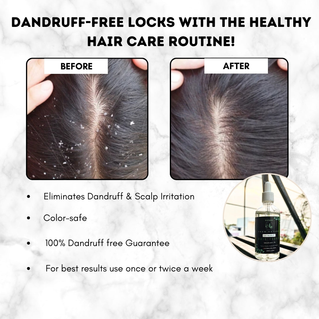 Anti-Dandruff Scalp Reset Comb