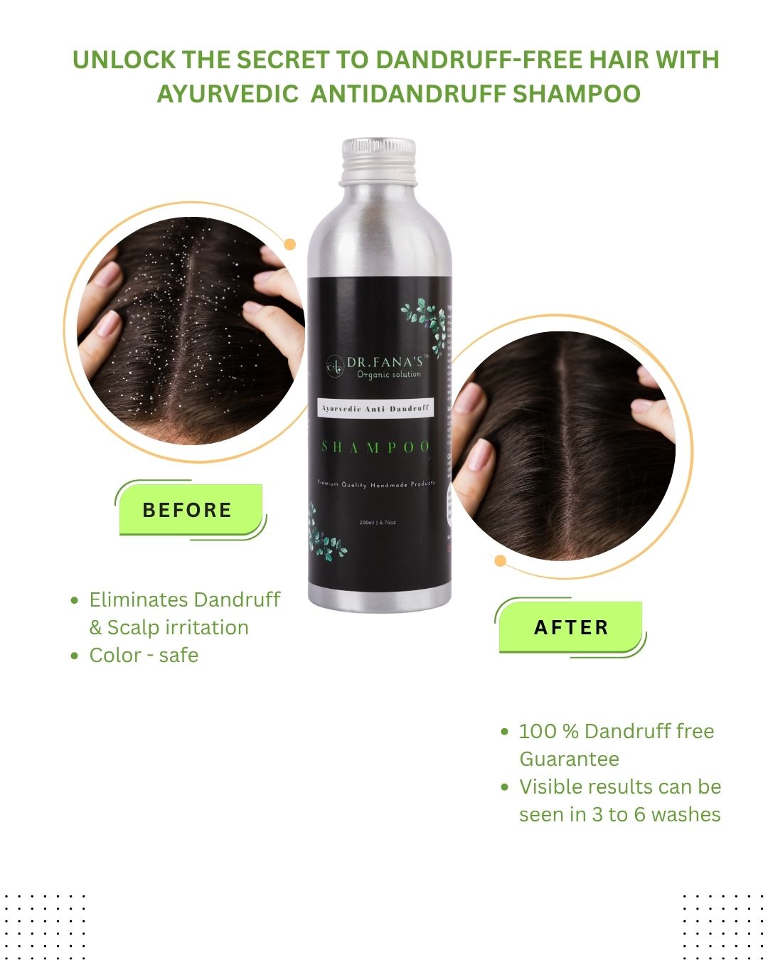 ANTI-Dandruff Shampoo